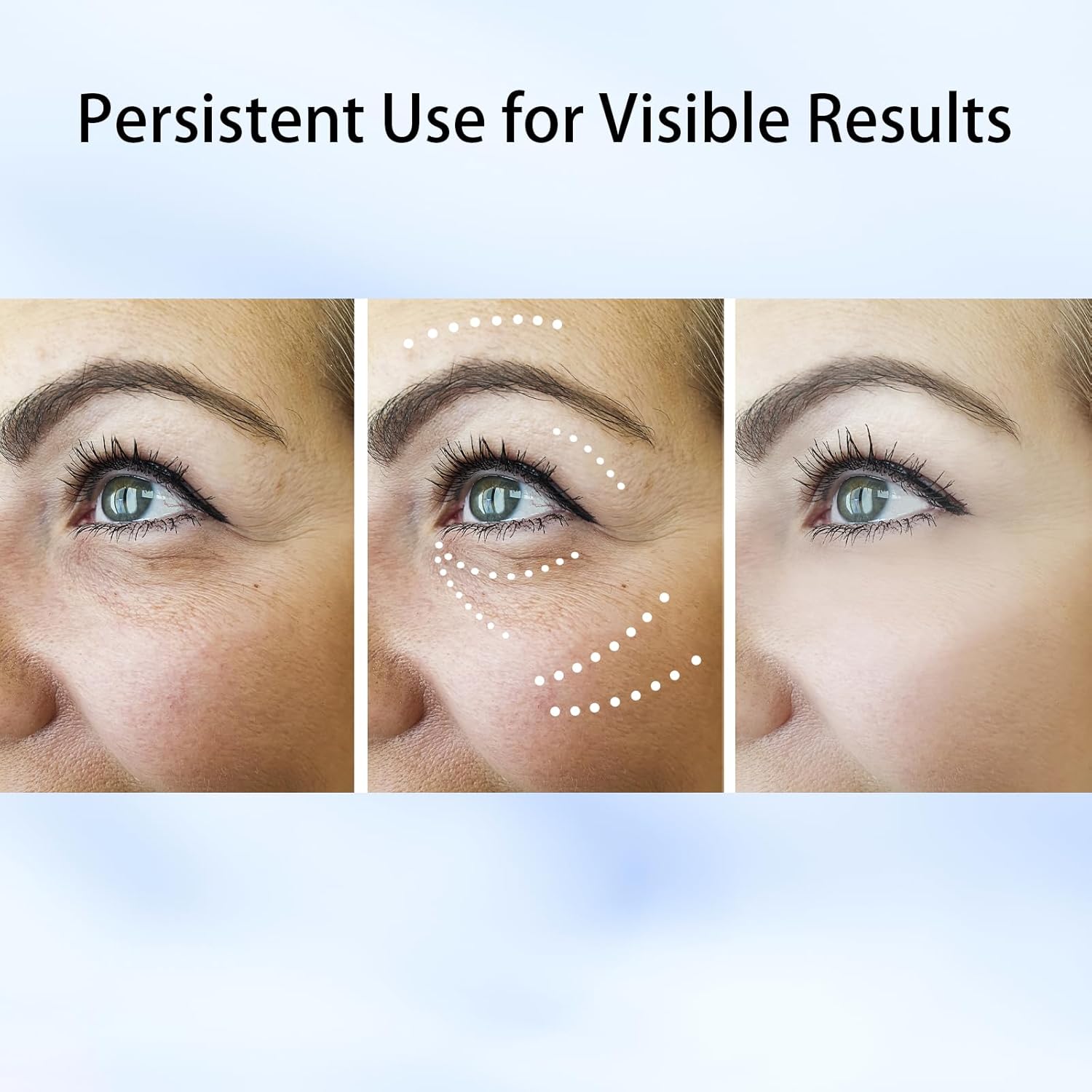 Facial Massager Face and Neck, Beauty Face Lifting Device Tightening and Lifting Skin Care Beauty Equipment